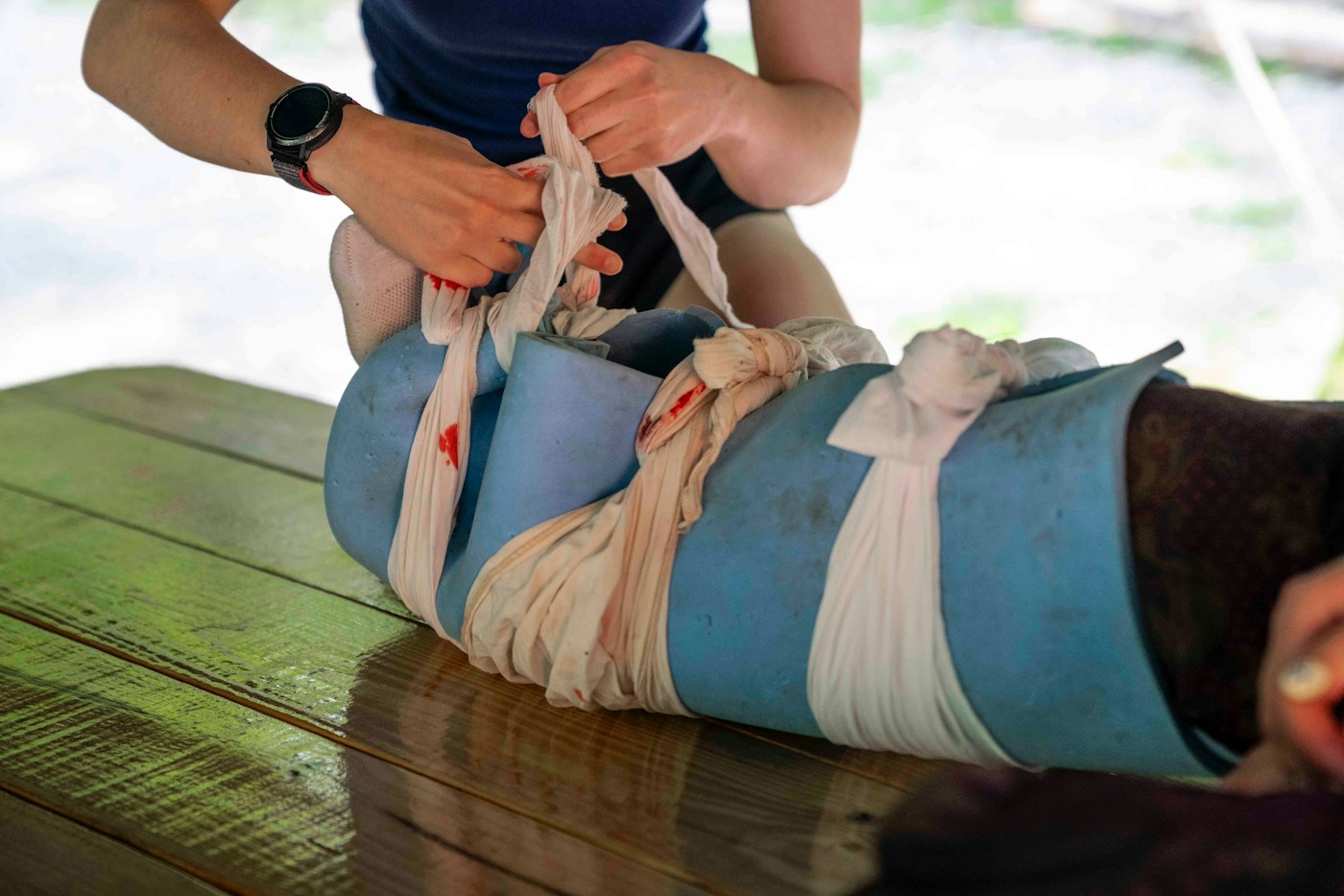 A splint being applied to an injured leg
